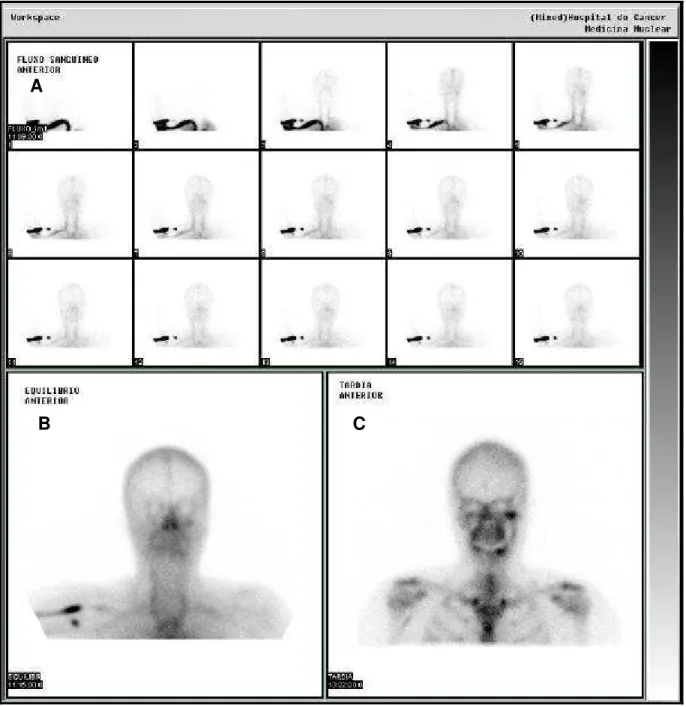 Figura 4.3 - Imagens planares de crânio e mandíbula: A) Fluxo sanguíneo em intervalos de 1s demonstrando ausência de anormalidades