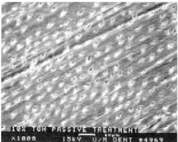 FIGURA 2.16 - Fotomicrografia eletrônica de varredura mostrando a superfície dentinária condicionada com ácido poliacrílico a 10% por 30s, de modo passivo