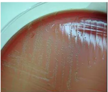 Figura 2 - Cultivo de 48 horas de Erysipelothrix  spp. em ágar sangue ázida 
