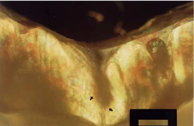Figura 7 – Fotomicrografia em secção longitudinal de uma lesão de cárie artificial na  fissura de um espécime do GIII (setas)
