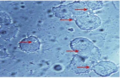 Figura 7: Microfotografia de células THP-1 diferenciadas para macrófagos, em campo  claro, após 1 hora de infecção por Mycobacterium tuberculosis