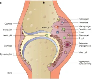 Figure 3. Representative scheme illustrating the differences between healthy (a) and rheumatoid joints (b)