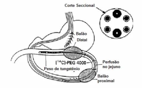 Figura  8  -  Apresentação esquemática da técnica denominada Loc-I-Gut, permitindo  perfusão intestinal seccional em humanos (adaptado de Petri et al., 2003)(51) 