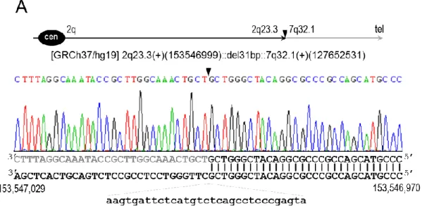 Figure 4.7: Breakpoints of t(2;7)(q23.3;q32.1) at nucleotide resolution. Breakpoints of both der(2) and der(7) are depicted  by a black inverted triangle