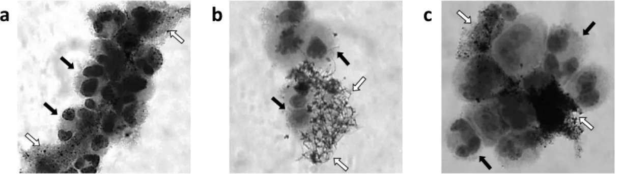 Figure 8. The three studied nanomaterials over or attached to Giemsa-stained BEAS-2B cells (1000x  magnification): a – NM-400; b – NM-401; c – NM-402