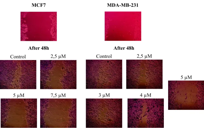Figure  3.4.  Microscope  photos  of  the  cell  monolayers  and  scratches,  done  before  introducing  the  drug  (above)  and  the  same  areas  after  48h  of  treatment  (below)  with  different concentrations of Cu(hin) 2  and a control