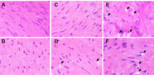 Figure 6 Histopathology of myocardium from experimental animals. Representative images of left ventricular histology from experimental animals stained with hematoxylin  and eosin are shown