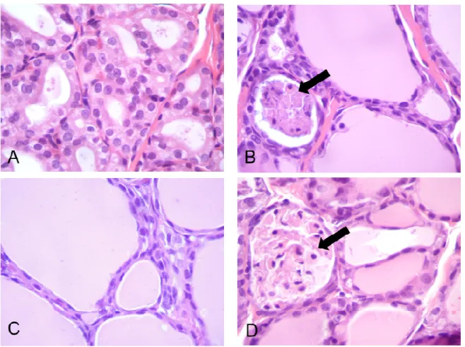 Figura 7 –   Histopatologia da tireoide dos ratos que foram tratados, durante 28 dias, com 0 (CO),  25 mg/kg (MI25), 40 mg/kg (MI40) e 60 mg/kg (MI60) de mimosina  