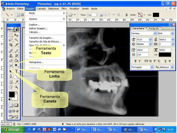 Figura 4.1- Radiografia digitalizada e recursos disponibilizados pelo software utilizado 