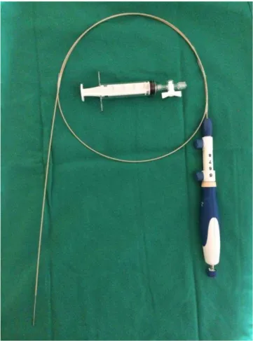 Figura 6 -  Agulha de punção aspirativa utilizada no exame de ecoendoscopia 