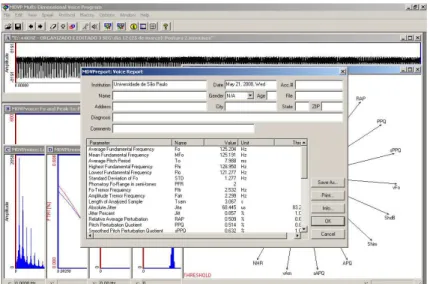 Figura  6  –   Janela  MDVP.  Janela  do  programa  MDVP  com  os  valores  numéricos  das  medidas  acústicas,  representadas no gráfico da figura, gerados do sinal de voz