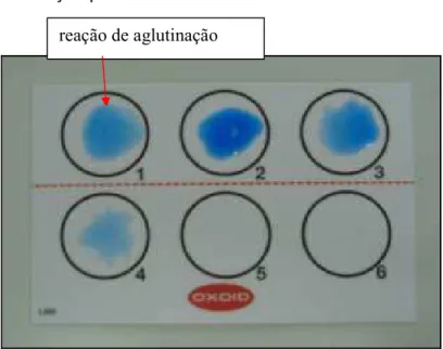 Figura 11: Reações observadas no teste de Látex Oxoid® para identificação de sp.