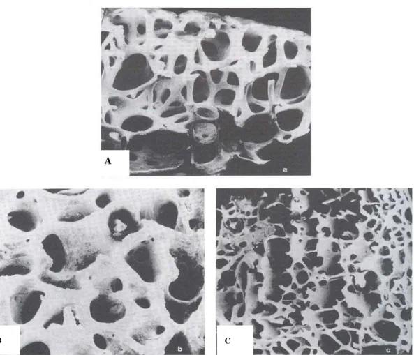 FIGURA 4- Microscopia Eletrônica de Varredura: estrutura do osso esponjoso . 