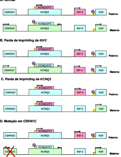 Figura 1: Mecanismos genéticos que causam BWS. A. Região 11p15 materna e paterna normais