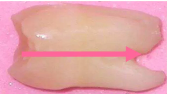 FIGURA 1: Seta ilustrativa demonstrando o sentido do seccionamento dos dentes 