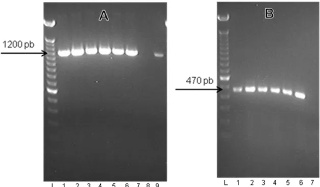 Figura 1  –  Eletroforese em gel de agarose a 1% corado com brometo de etídeo das reações de RT- RT-PCR