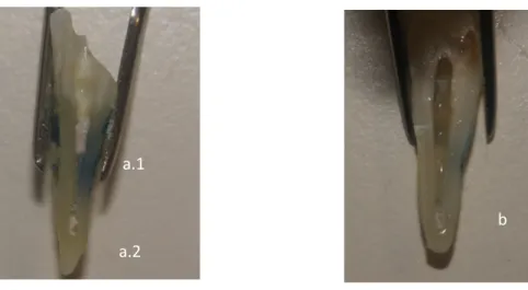 Figura 3: Fotografia do completo preenchimento do sulco coronal (a.1), a mistura cobre mais de metade do  sulco apical (a.2) e a mistura cobre menos de metade do sulco apical (b)