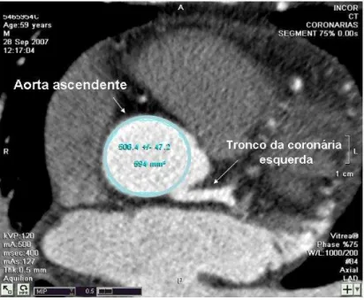 Figura  5  –   Aferição  de  parâmetros  de  qualidade  da  imagem  radiológica  à  tomografia  computadorizada