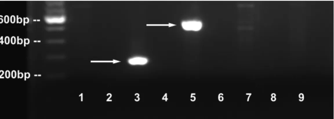 Fig. 3. Resultado do sequenciamento de melanopsina em células ZEM 2S, feito a partir de  produto amplificado com o par de primers IPF175 + IPB184