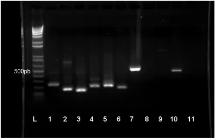 Fig. 5. Resultado do sequenciamento de receptor ETA em células ZEM 2S, feito a partir de  produto amplificado com o par de primers 14F + 17B