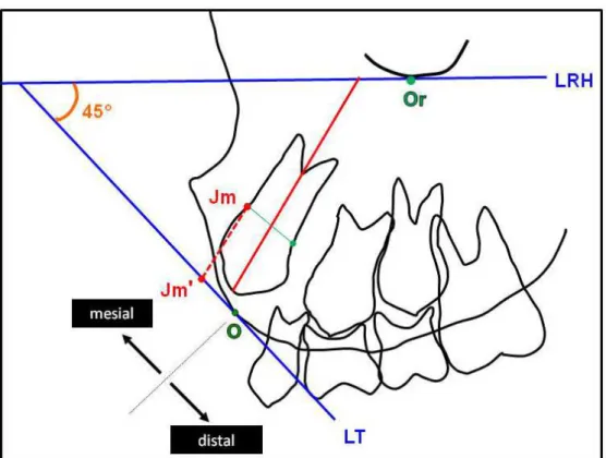 Figura 4.2 -  Desenho esquemático da determinação da posição do CSP em  relação à fissura alveolar 