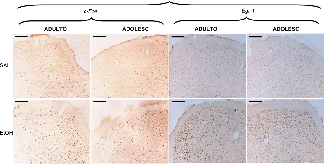 Figura 8. Fotomicrografias de secções coronais do cérebro de camundongos adultos (ADULTO) e adolescentes (ADOLESC) tratados agudamente com  solução controle (SAL) ou etanol (EtOH) mostrando as expressões de c-Fos e Egr-1 no CPF