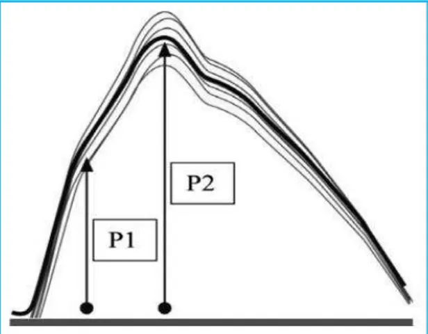 Figura 3 -   Tonometria arterial periférica (PAT) - onda de pulso. 