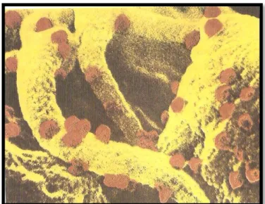 Figura  1:  Linfócito  T4  infetado  pelo  vírus  da  sida  (Retirado  de  Daudel e Montagnier, 1994)
