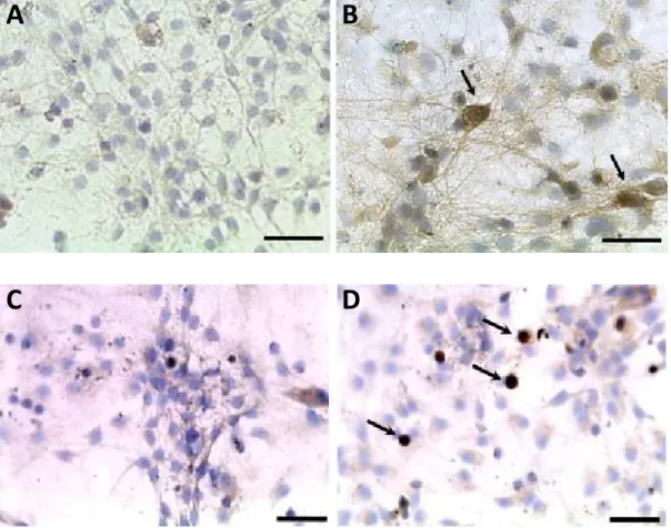 Figura  3.  Imagens  digitais  ilustrativas  de  cultura  de  células  do  hipocampo  após  exposição  a  0,5nM  (A  e  C)  e  1nM  (B  e  D)  de  rotenona  durante  48h  submetidas a técnica de imunocitoquímica, apresentando marcação positiva  para Tau hi