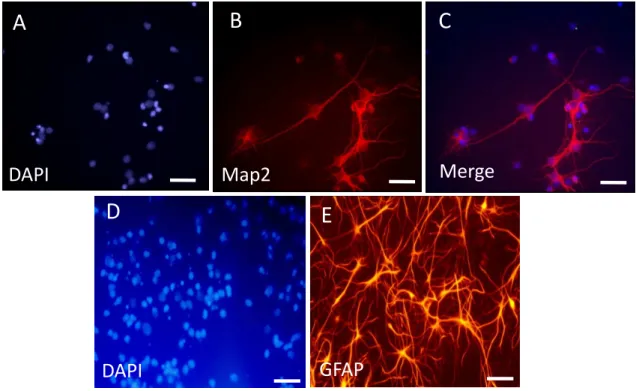 Figura  12.  Imagens  digitais  representativas  de  cultura  de  células  do  hipocampo  de  ratos  Lewis  neonatos  ilustrando  a  marcação  dos  núcleos  (DAPI, A e D), a imunorreatividade ao Map2 (neurônios) (B), a colocalização  da  marcação  do  Map2