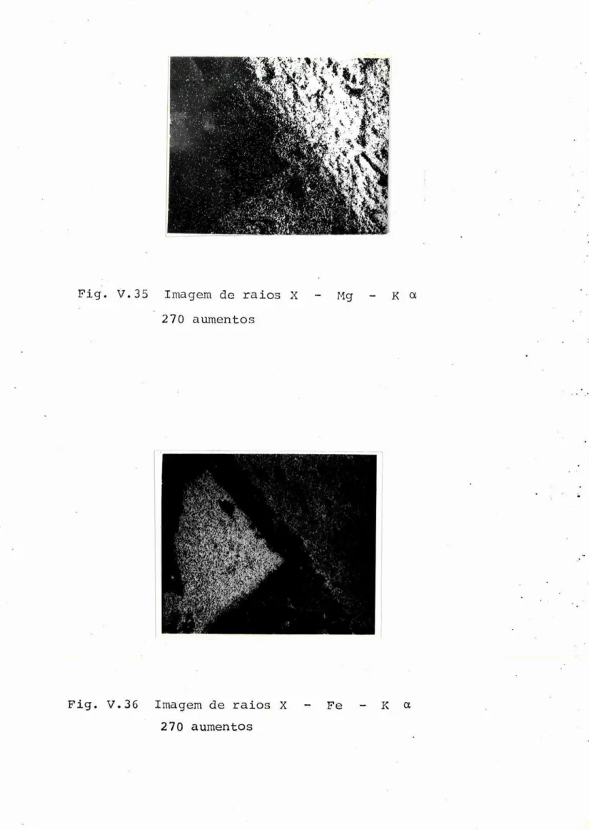 Fig. V.35  Imagem  de  raios  X