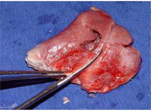 Figura 3. Técnica de Fulton para separar as massas cardíacas. Observa-se na peça, já sem os átrios, o corte  guiado pela artéria Interventricular anterior, rente ao septo interventricular, para separá-lo do ventrículo  direito