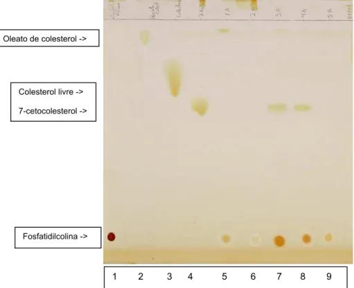 Figura 4: Cromatografia em camada delgada das frações obtidas por  ultracentrifugação após incubação da LDE com 7-cetocolesterol