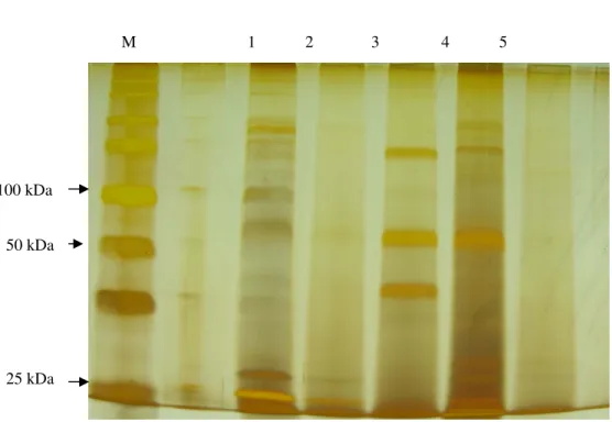 Figura 4. Perfil de proteínas extracelulares de X.fastidiosa de citros e videira: M) marcador  molecular; 1) X 0 ; 2) SR3; 3) SR28; 4) 9713; 5) Temecula
