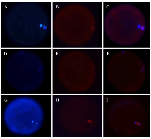 Figura 8 - Organização e distribuição dos microtúbulos nos oócitos em MII e após a ativação partenogenética  induzida pelo cálcio ionóforo, tratados ou não com o inibidor de PKC (BIM)