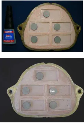 Fig. 17 – Posicionamento dos discos e inclusão/prensagem da resina acrílica  termopolimerizável