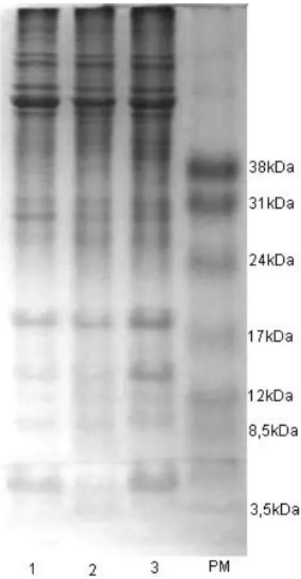Figura 2: Análise do perfil de proteínas do extrato antigênico obtido. 