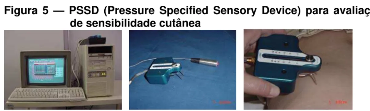 Figura 5 — PSSD (Pressure Specified Sensory Device) para avaliação  de sensibilidade cutânea  