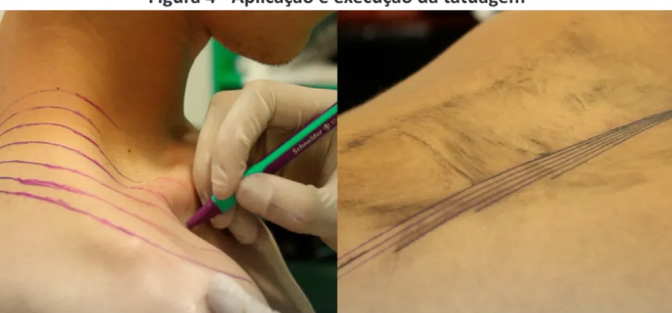 Figura 4 - Aplicação e execução da tatuagem