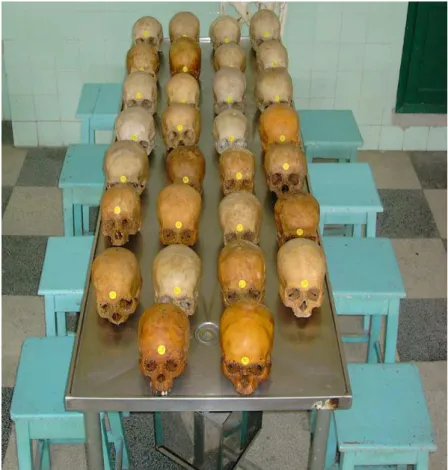 Figura 4.1- Amostra da pesquisa, consistindo em 30 crânios humanos secos de indivíduos adultos 