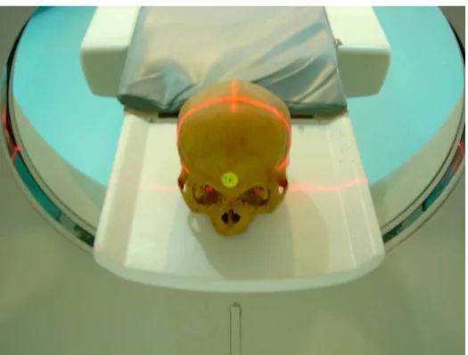 Figura  4.4-  Crânio  posicionado  na  mesa  e  no  gantry;  direcionamento  do  laser  de  baixa potência nas suturas coronal e sagital 