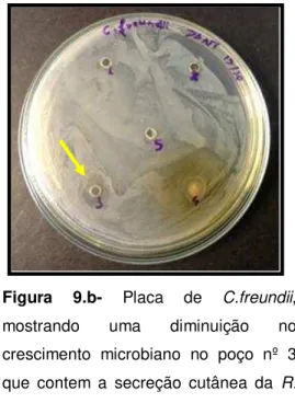 Figura  9.a-  Placa  de  S.  aureus,  onde  se  pode  observar  a  formação  de  um  grande  halo  em  volta  do  poço  nº4  que  contém  o  veneno  da  glândula  paratoide  de  R.icterica  além  de  um  crescimento  de  algumas  colônias em seu entorno