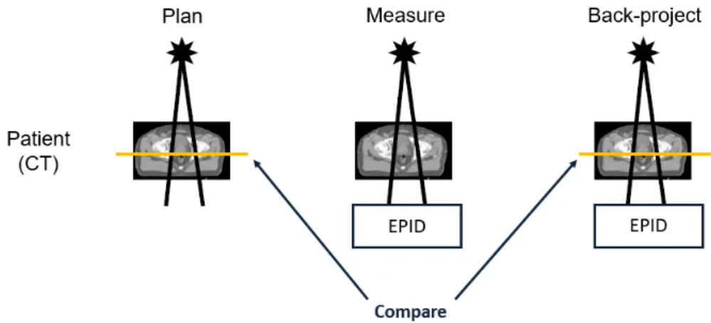 Figure 2.8: Schematic presentation of EPID in vivo dosimetry procedure.