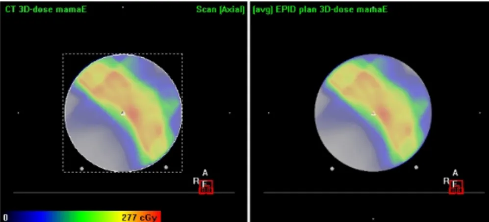 Figure 3.12: Comparison between patient plan calculated in ArcCHECK phantom (planned dose) with Monaco software and portal dose reconstructed inside the