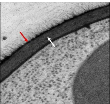 Figura 2. Microscopia eletrônica de transmissão da parede celular de C. albicans . Seta vermelha mostra a camada mais externa composta por proteínas de parede celular e a seta branca identifica a camada rica em quitina e â-glucanas