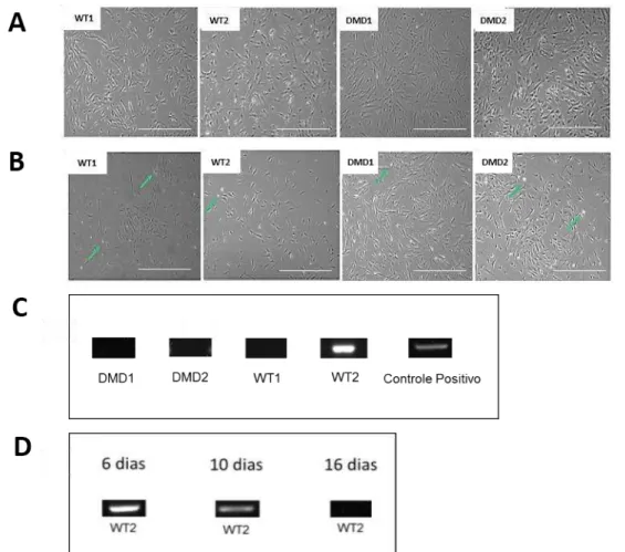 Figura 6  –  Caracterização morfológica e teste de micoplasma nas SHED de pacientes com e sem DMD  