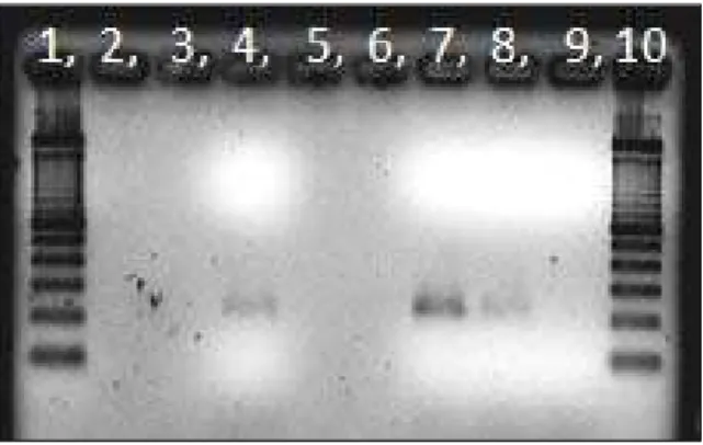 Figura 10.  Foto de gel de agarose (1,5%) corado com brometo de etídio, após  eletroforese do produto da PCR em tempo real que amplifica fragmento de  aproximadamente 200pb do gene NS5 de Flavivirus