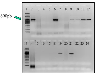 Figura 9. Foto de eletroforese em gel de agarose a 1,8%, corado com  brometo de etídio e realizado após a segunda etapa da nested PCR para  visualização do fragmento de 890pb amplificado do gene gdh de Giardia