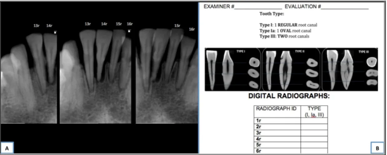 Figura 9:  (A) Imagens radiográficas com identificação da ordem de análise;  (B) Folha de respostas  distribuída  aos  examinadores  para  que  apontassem  o  tipo  anatômico  que  julgavam  correto  ao  ver  imagens radiográficas de cada dente