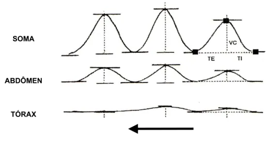 Figura 8.  Representação de traçado de PRI mostrando as curvas referentes aos  deslocamentos do tórax, abdômen e soma